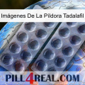 Imágenes De La Píldora Tadalafil 31